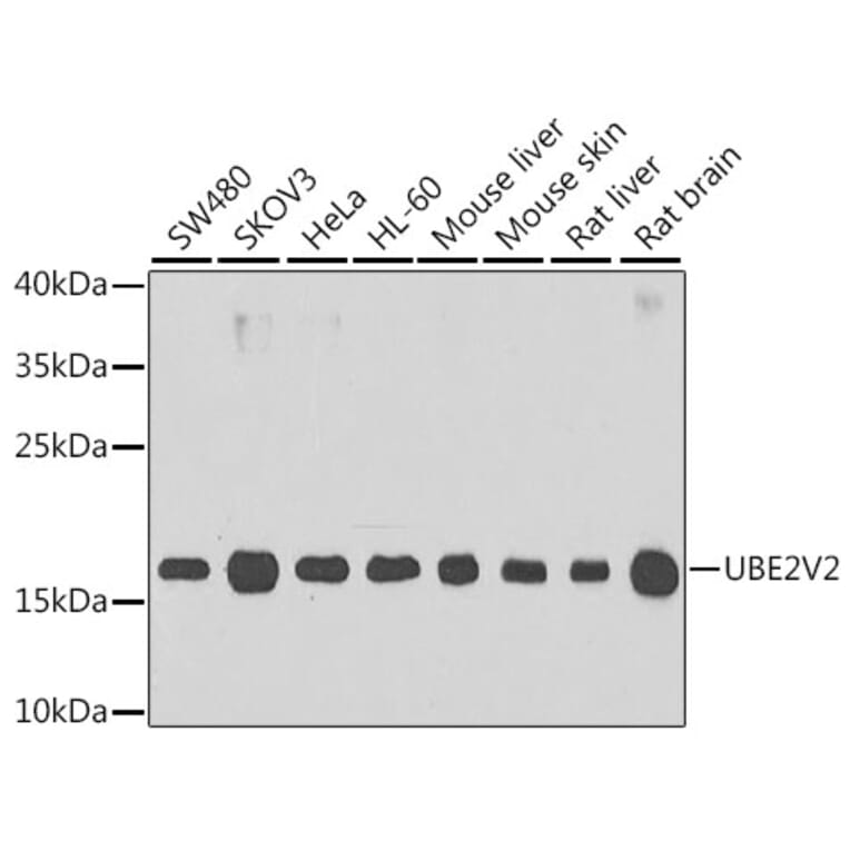 Western Blot - Anti-MMS2 Antibody (A15474) - Antibodies.com