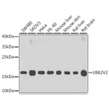 Western Blot - Anti-MMS2 Antibody (A15474) - Antibodies.com