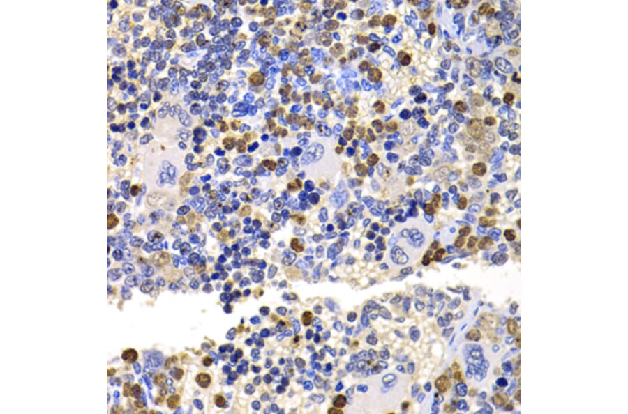 Immunohistochemistry - Anti-MMS2 Antibody (A15474) - Antibodies.com