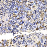 Immunohistochemistry - Anti-MMS2 Antibody (A15474) - Antibodies.com