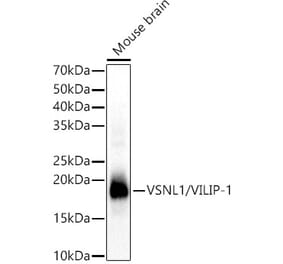 Western Blot - Anti-VILIP1 Antibody (A15475) - Antibodies.com