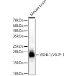 Western Blot - Anti-VILIP1 Antibody (A15475) - Antibodies.com