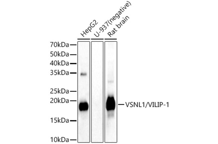 Western Blot - Anti-VILIP1 Antibody (A15475) - Antibodies.com