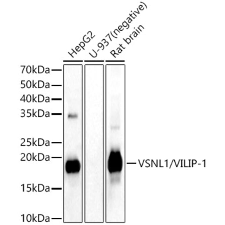 Western Blot - Anti-VILIP1 Antibody (A15475) - Antibodies.com