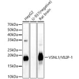 Western Blot - Anti-VILIP1 Antibody (A15475) - Antibodies.com