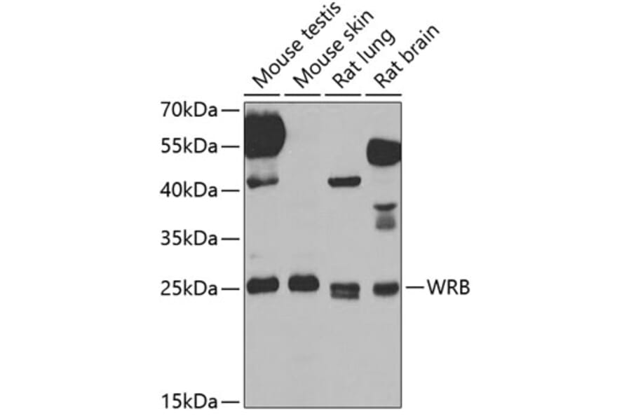 Western Blot - Anti-Tryptophan rich protein Antibody (A15476) - Antibodies.com