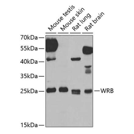 Western Blot - Anti-Tryptophan rich protein Antibody (A15476) - Antibodies.com