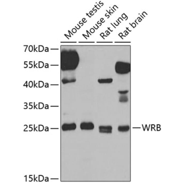 Western Blot - Anti-Tryptophan rich protein Antibody (A15476) - Antibodies.com