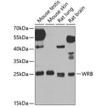 Western Blot - Anti-Tryptophan rich protein Antibody (A15476) - Antibodies.com