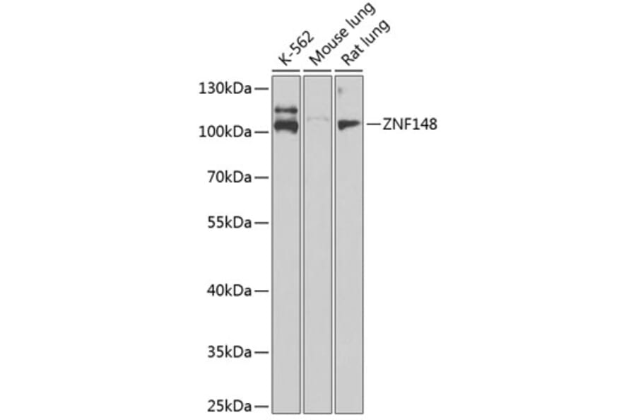 Western Blot - Anti-ZNF148 Antibody (A15477) - Antibodies.com