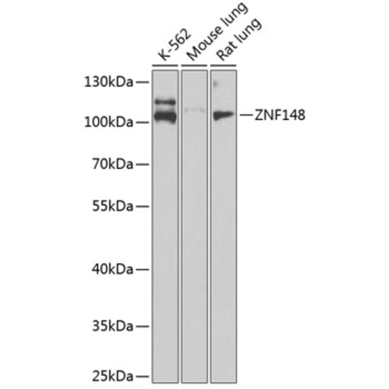 Western Blot - Anti-ZNF148 Antibody (A15477) - Antibodies.com