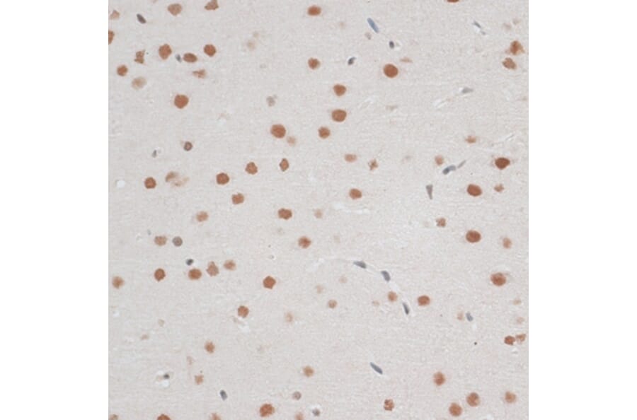 Immunohistochemistry - Anti-ZNF148 Antibody (A15477) - Antibodies.com