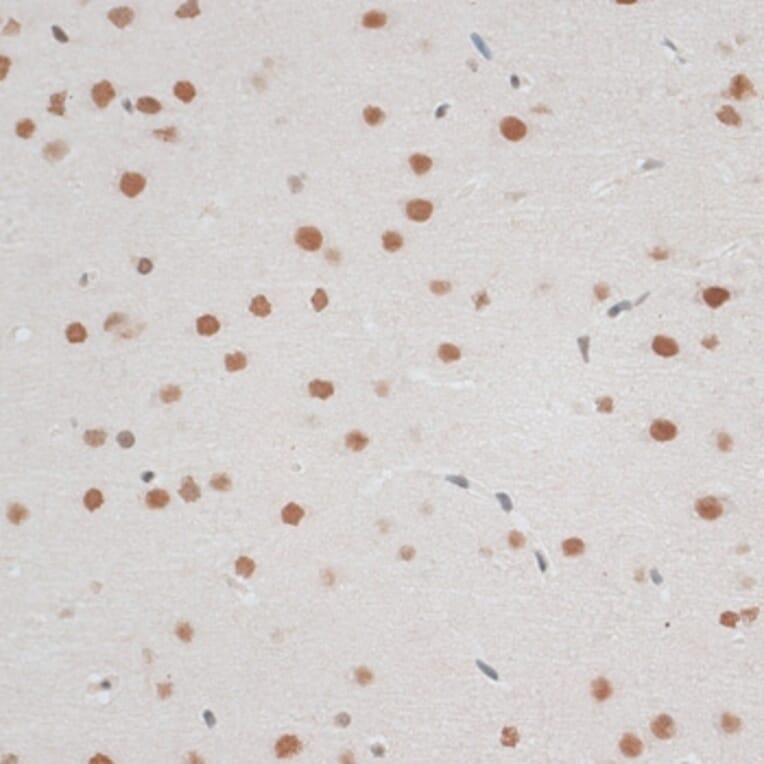Immunohistochemistry - Anti-ZNF148 Antibody (A15477) - Antibodies.com