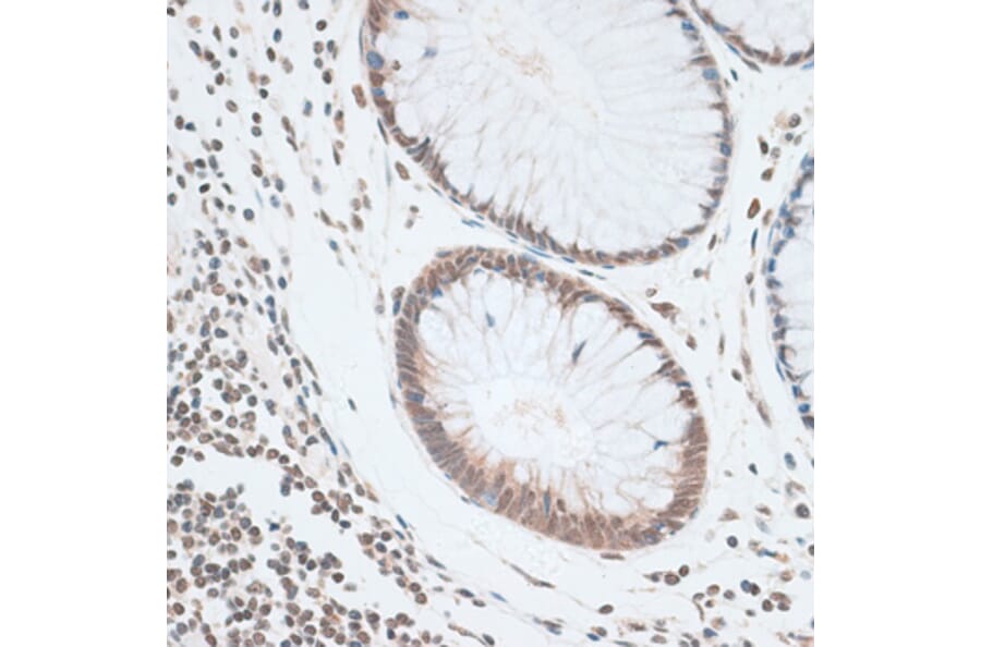 Immunohistochemistry - Anti-ZNF148 Antibody (A15477) - Antibodies.com