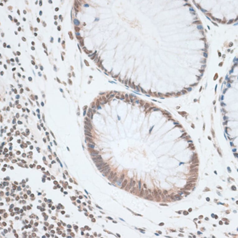 Immunohistochemistry - Anti-ZNF148 Antibody (A15477) - Antibodies.com
