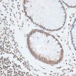 Immunohistochemistry - Anti-ZNF148 Antibody (A15477) - Antibodies.com