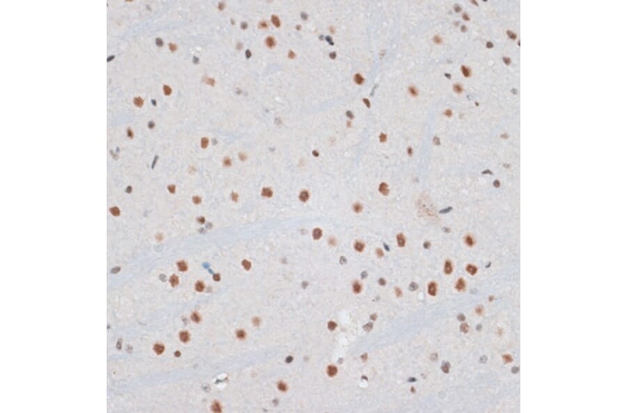 Immunohistochemistry - Anti-ZNF148 Antibody (A15477) - Antibodies.com