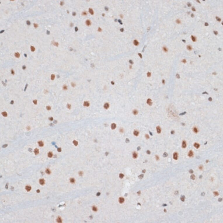 Immunohistochemistry - Anti-ZNF148 Antibody (A15477) - Antibodies.com
