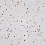 Immunohistochemistry - Anti-ZNF148 Antibody (A15477) - Antibodies.com