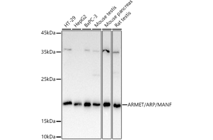 Western Blot - Anti-ARMET/ARP Antibody (A15479) - Antibodies.com