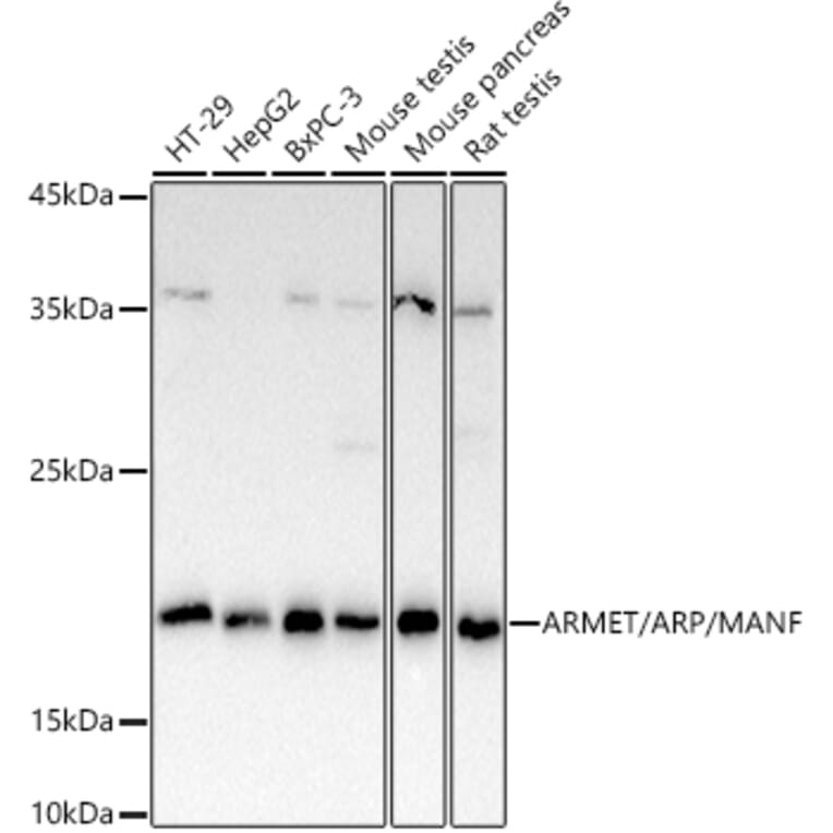 Western Blot - Anti-ARMET/ARP Antibody (A15479) - Antibodies.com