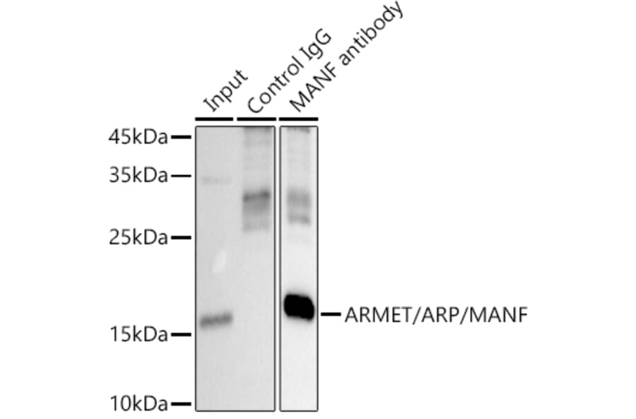 Western Blot - Anti-ARMET/ARP Antibody (A15479) - Antibodies.com