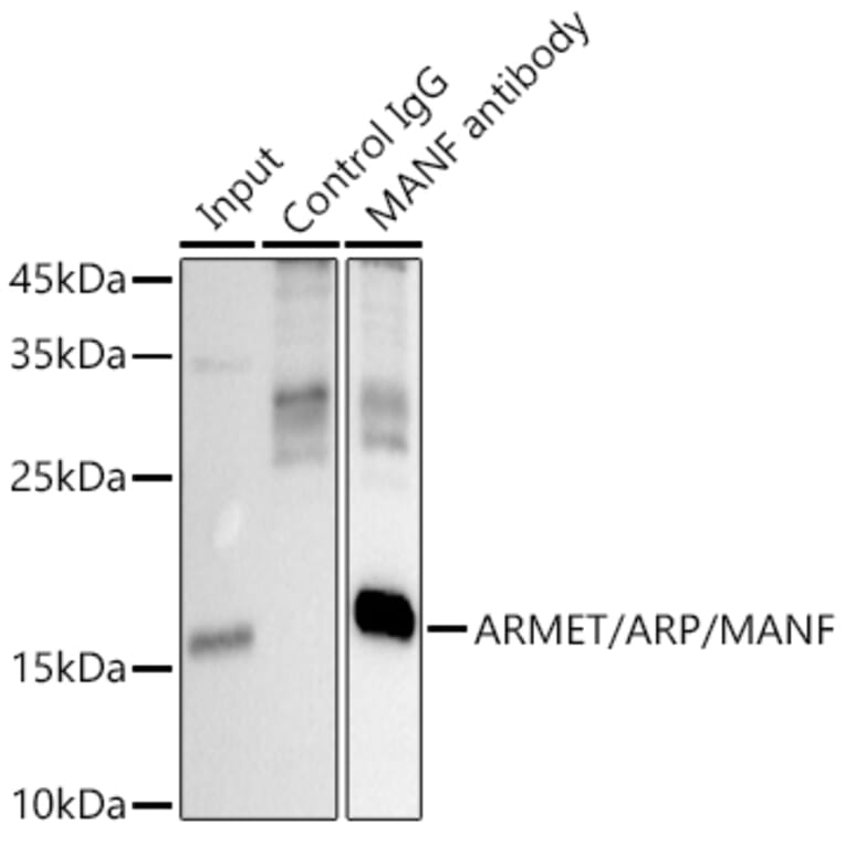 Western Blot - Anti-ARMET/ARP Antibody (A15479) - Antibodies.com