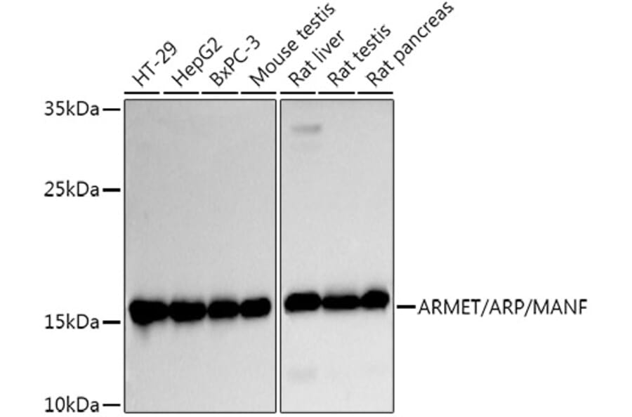 Western Blot - Anti-ARMET/ARP Antibody (A15479) - Antibodies.com