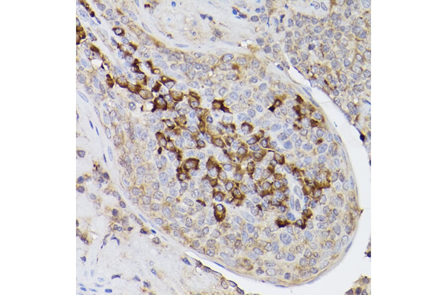 Immunohistochemistry - Anti-ARMET/ARP Antibody (A15479) - Antibodies.com