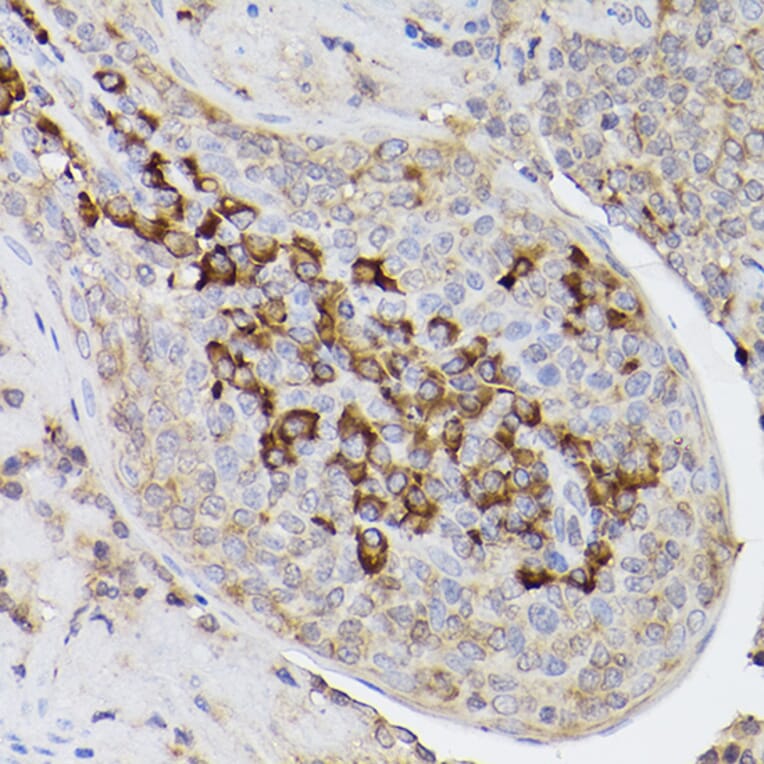Immunohistochemistry - Anti-ARMET/ARP Antibody (A15479) - Antibodies.com