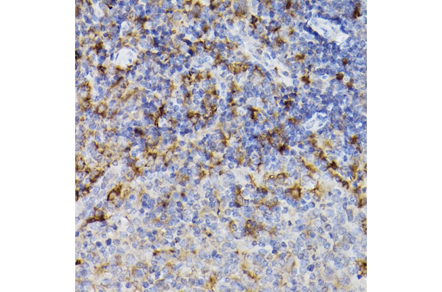 Immunohistochemistry - Anti-ARMET/ARP Antibody (A15479) - Antibodies.com
