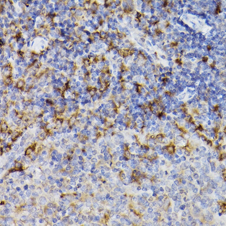 Immunohistochemistry - Anti-ARMET/ARP Antibody (A15479) - Antibodies.com