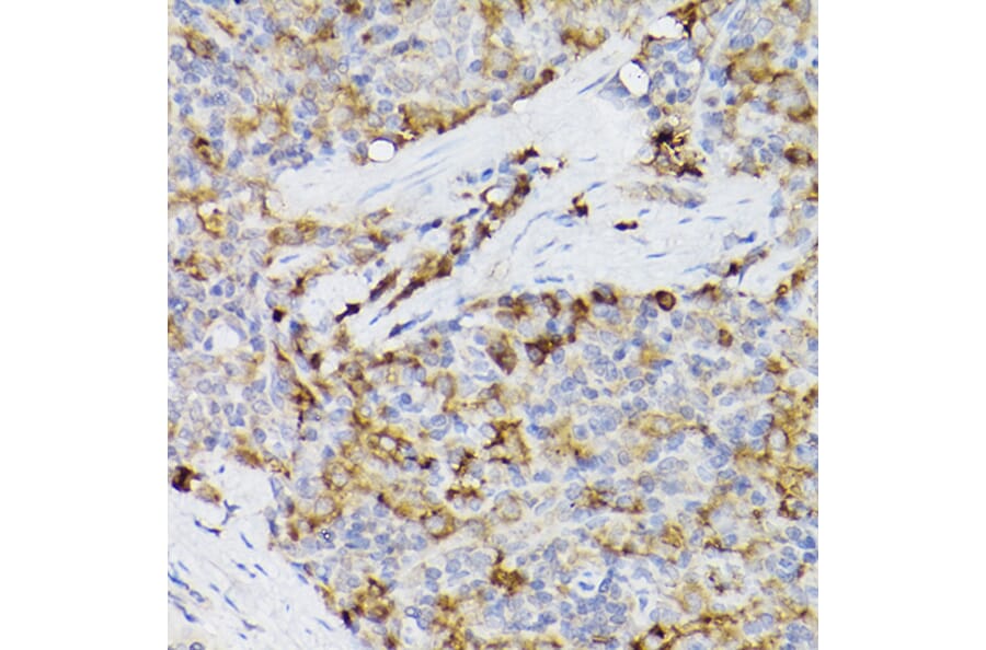 Immunohistochemistry - Anti-ARMET/ARP Antibody (A15479) - Antibodies.com