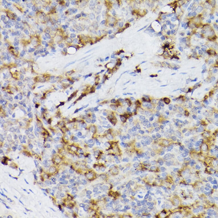Immunohistochemistry - Anti-ARMET/ARP Antibody (A15479) - Antibodies.com