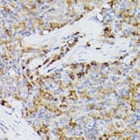 Immunohistochemistry - Anti-ARMET/ARP Antibody (A15479) - Antibodies.com