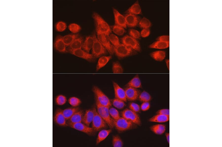 Immunofluorescence - Anti-ARMET/ARP Antibody (A15479) - Antibodies.com