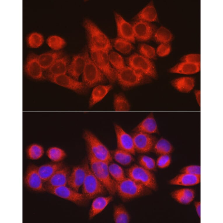 Immunofluorescence - Anti-ARMET/ARP Antibody (A15479) - Antibodies.com