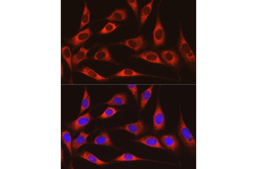 Immunofluorescence - Anti-ARMET/ARP Antibody (A15479) - Antibodies.com
