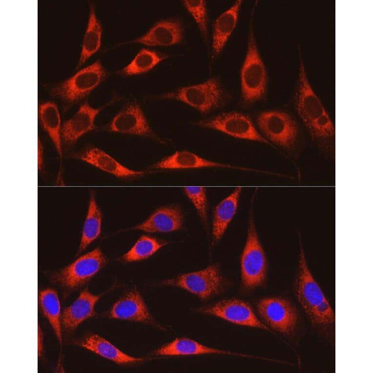 Immunofluorescence - Anti-ARMET/ARP Antibody (A15479) - Antibodies.com