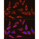 Immunofluorescence - Anti-ARMET/ARP Antibody (A15479) - Antibodies.com