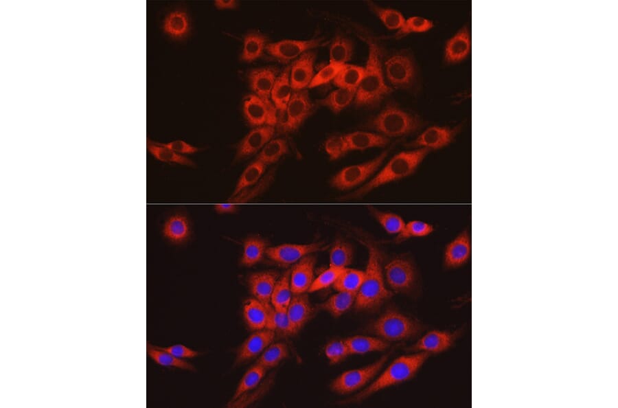 Immunofluorescence - Anti-ARMET/ARP Antibody (A15479) - Antibodies.com