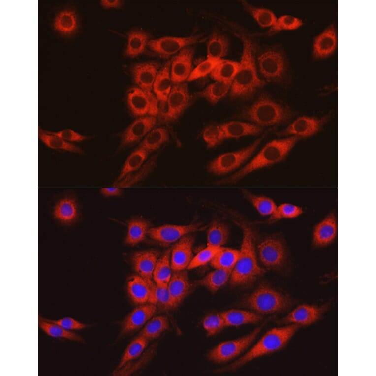 Immunofluorescence - Anti-ARMET/ARP Antibody (A15479) - Antibodies.com