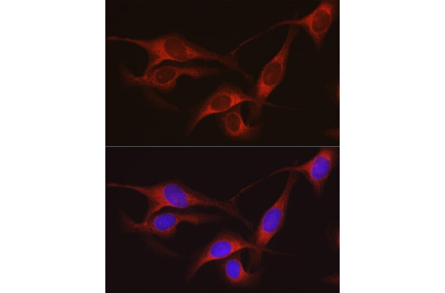 Immunofluorescence - Anti-ARMET/ARP Antibody (A15479) - Antibodies.com