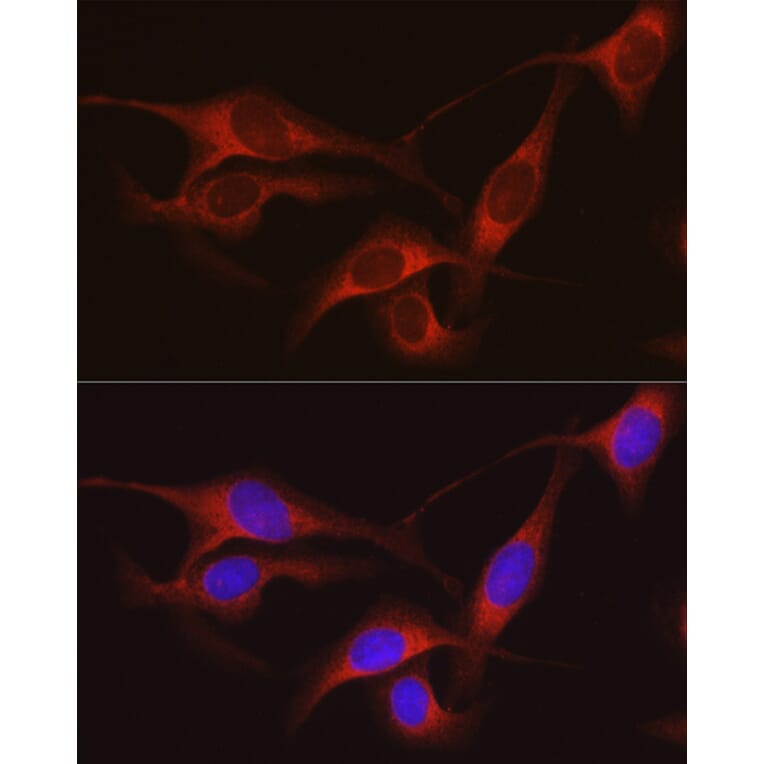 Immunofluorescence - Anti-ARMET/ARP Antibody (A15479) - Antibodies.com