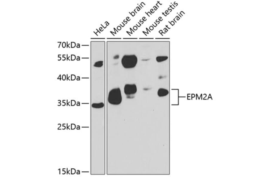Western Blot - Anti-EPM2A/Laforin Antibody (A15480) - Antibodies.com