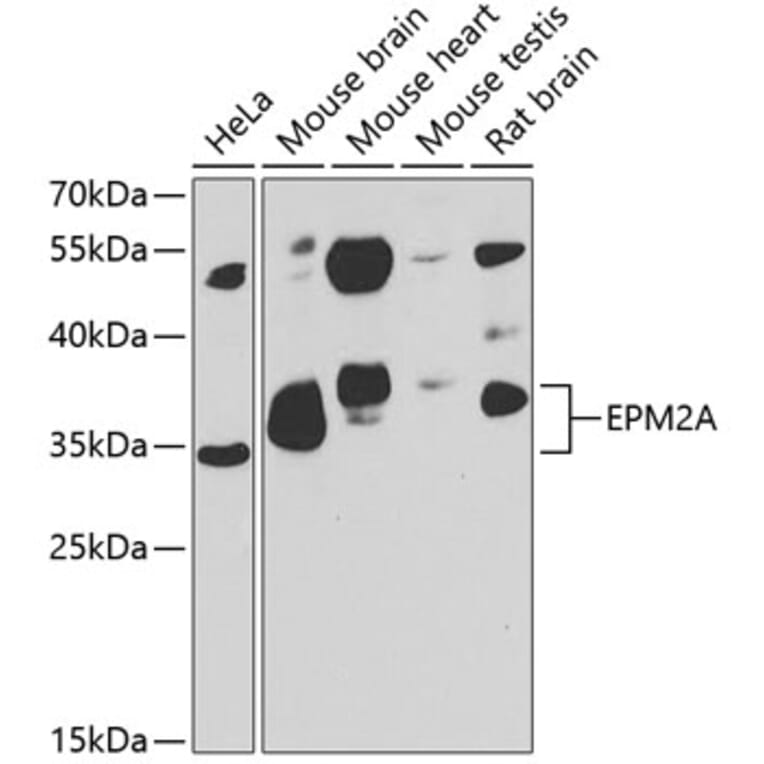 Western Blot - Anti-EPM2A/Laforin Antibody (A15480) - Antibodies.com