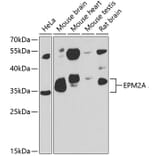 Western Blot - Anti-EPM2A/Laforin Antibody (A15480) - Antibodies.com