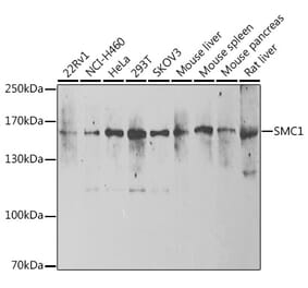 Western Blot - Anti-SMC1A Antibody (A15481) - Antibodies.com
