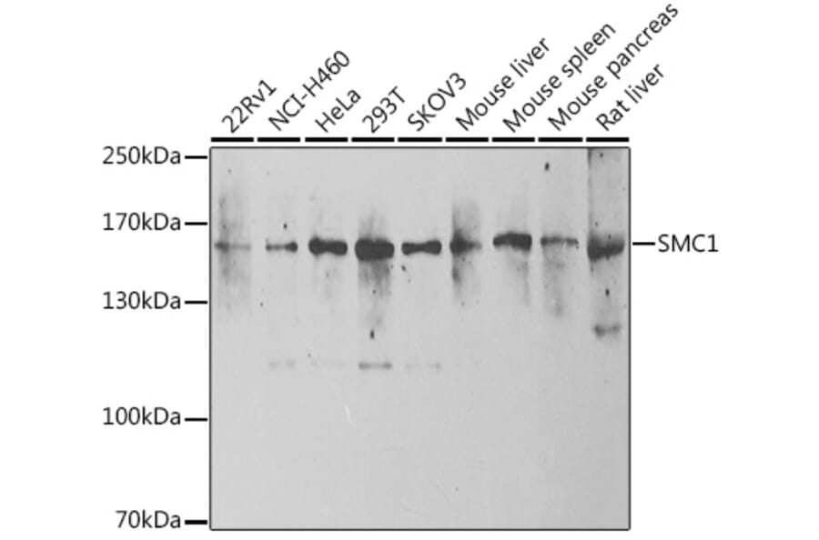 Western Blot - Anti-SMC1A Antibody (A15481) - Antibodies.com