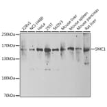 Western Blot - Anti-SMC1A Antibody (A15481) - Antibodies.com